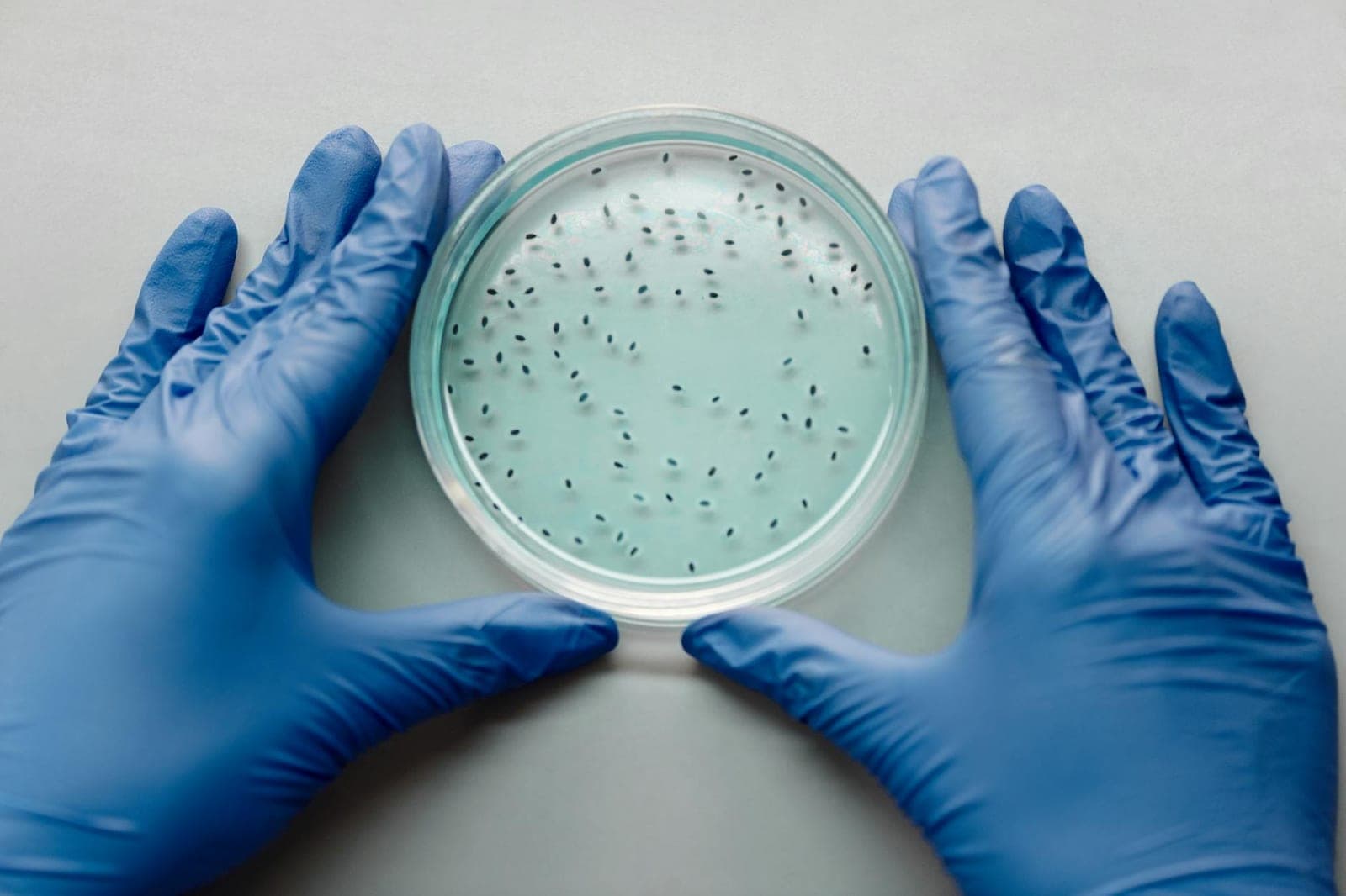 Scientist examining a bacterial culture in a petri dish.